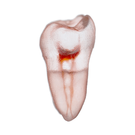 Orodeka Tooth Model Lower Molar A EACH